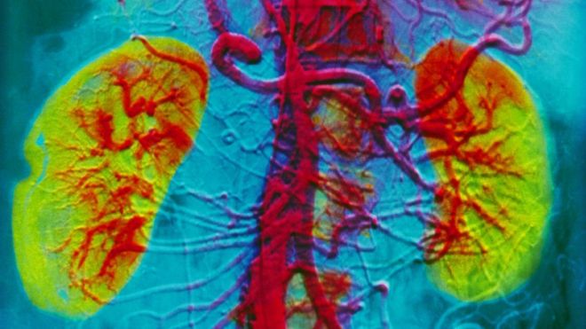 The Kidney & Hypertension Group of South Florida
